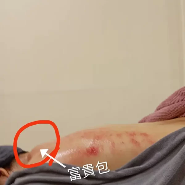 冠緻時尚美學-新北林口、艾草溫罐、暖宮按摩、經絡按摩、孕婦按摩、肌膚管理、熱蠟除毛-240905_服務案例_04