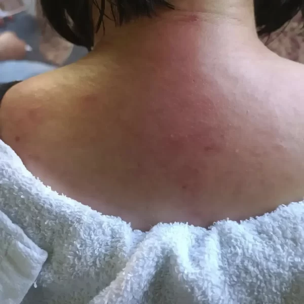 冠緻時尚美學-新北林口、艾草溫罐、暖宮按摩、經絡按摩、孕婦按摩、肌膚管理、熱蠟除毛-服務案例-10