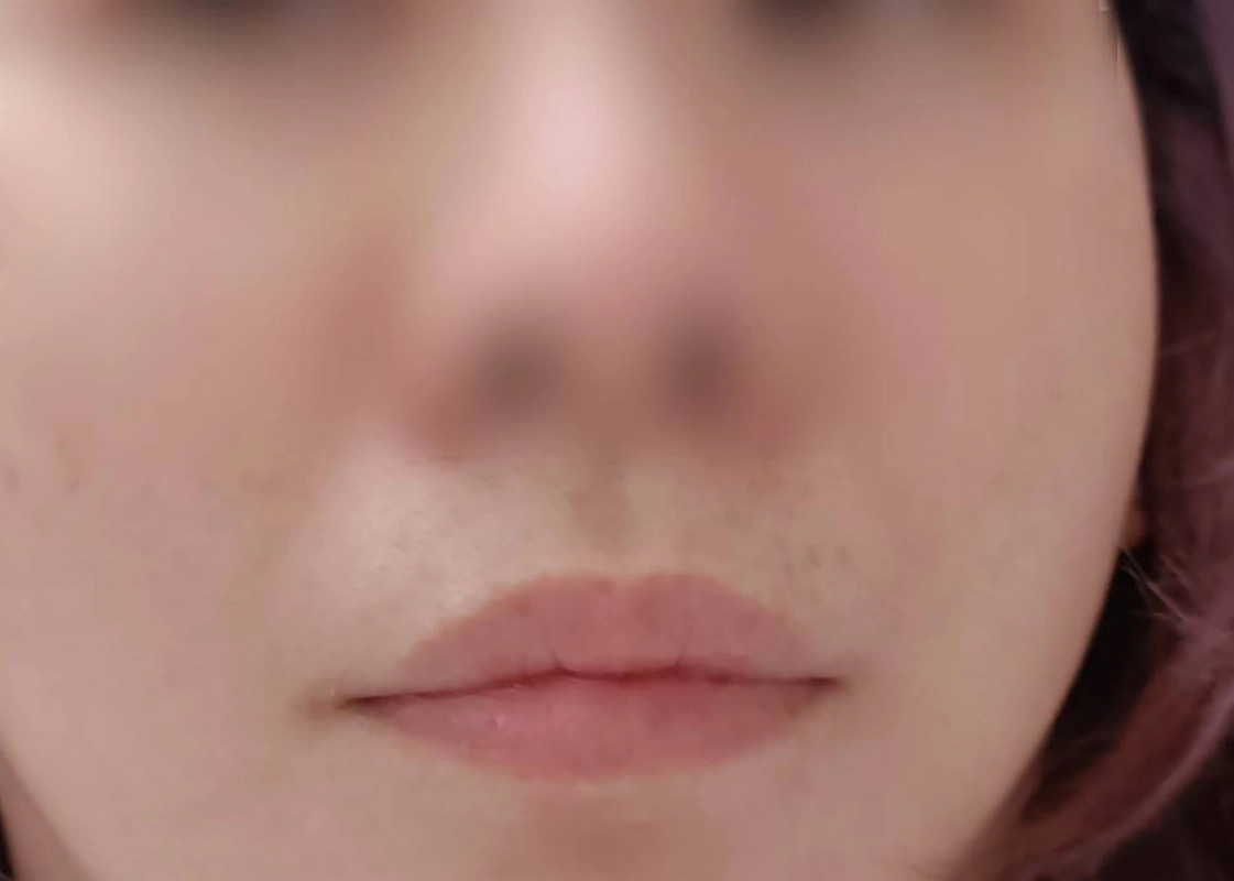 Before
