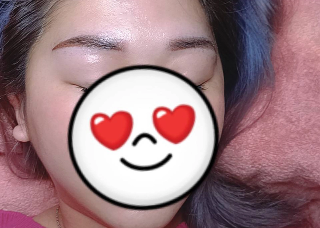 After