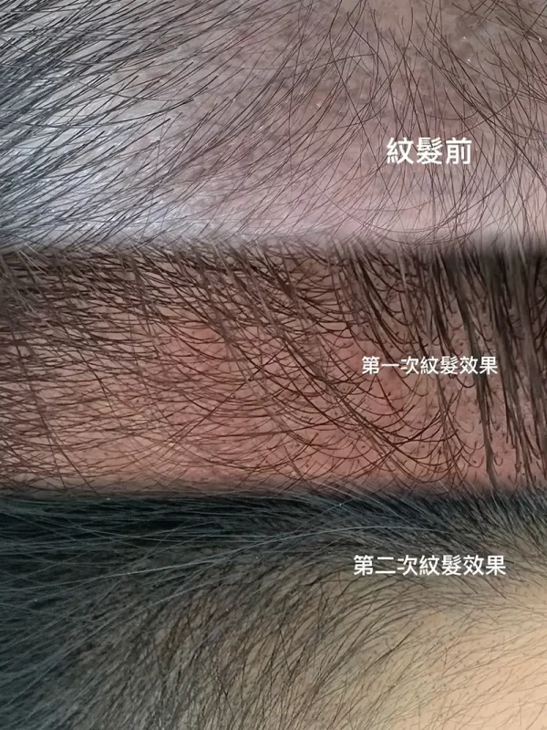 台北大安霧眉推薦】葳妮亞國際美學-大安半永久紋繡,大安美甲,大安美睫推薦_作品集_紋髮_03