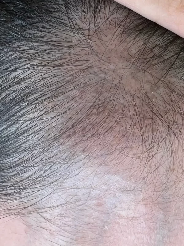 台北大安霧眉推薦】葳妮亞國際美學-大安半永久紋繡,大安美甲,大安美睫推薦_作品集_紋髮_04