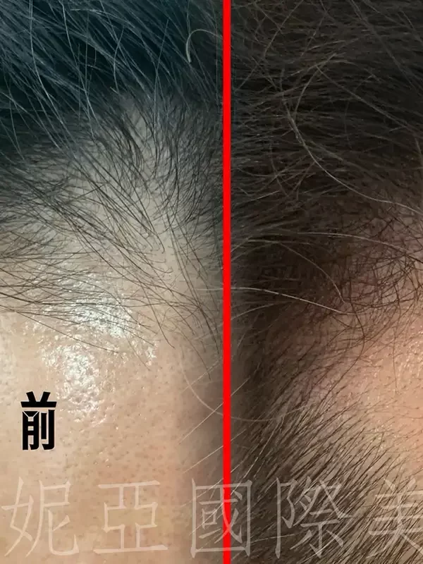 台北大安霧眉推薦】葳妮亞國際美學-大安半永久紋繡,大安美甲,大安美睫推薦_作品集_紋髮_09
